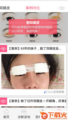双眼皮咨询APP下载截图2