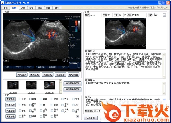 易捷超声工作站正式版 v1.8.5.0 官方版 截图1