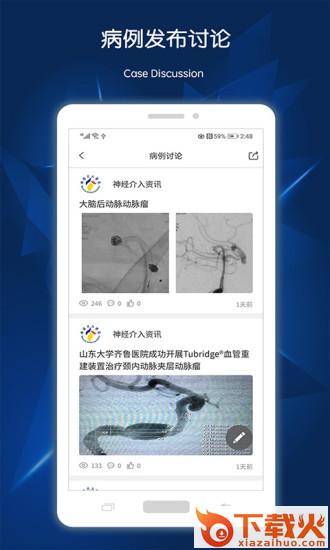 神经介入资讯app截图1