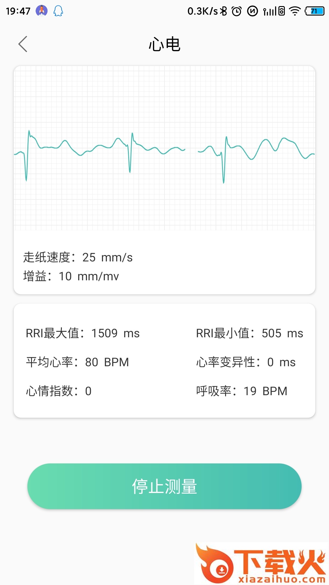 MinttiVision智能健康监护仪截图1